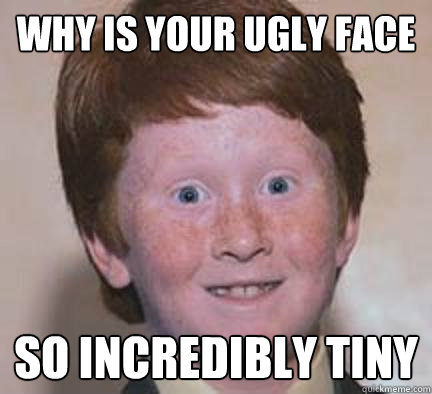 Your face is so ugly